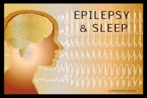 EPILEPSY AND SLEEP