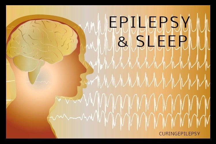 Epilepsy and Sleep Apnea: A Collaborative Treatment