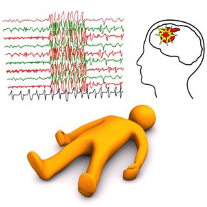 risk factors of epilepsy