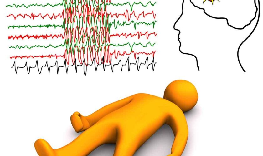 Risk Factors for Developing Epilepsy